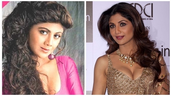 ഇവരുടെ മാറ്റത്തിന് പിന്നിലെ രഹസ്യം; പ്ലാസ്റ്റിക് സർജറിയും കോസ്മറ്റിക് സർജറിയും നടത്തിയ താരങ്ങൾ