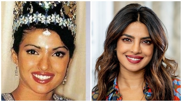 ഇവരുടെ മാറ്റത്തിന് പിന്നിലെ രഹസ്യം; പ്ലാസ്റ്റിക് സർജറിയും കോസ്മറ്റിക് സർജറിയും നടത്തിയ താരങ്ങൾ