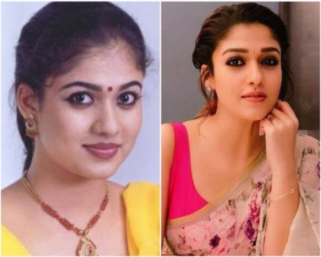 PHOTOS : பிளாஸ்டிக் சர்ஜரி மூலம் அழகுக்கு அழகு சேர்த்த டாப் 10  தென்னிந்திய நடிகைகள்.. யார் யாருன்னு தெரியுமா? லிஸ்ட் இதோ!
