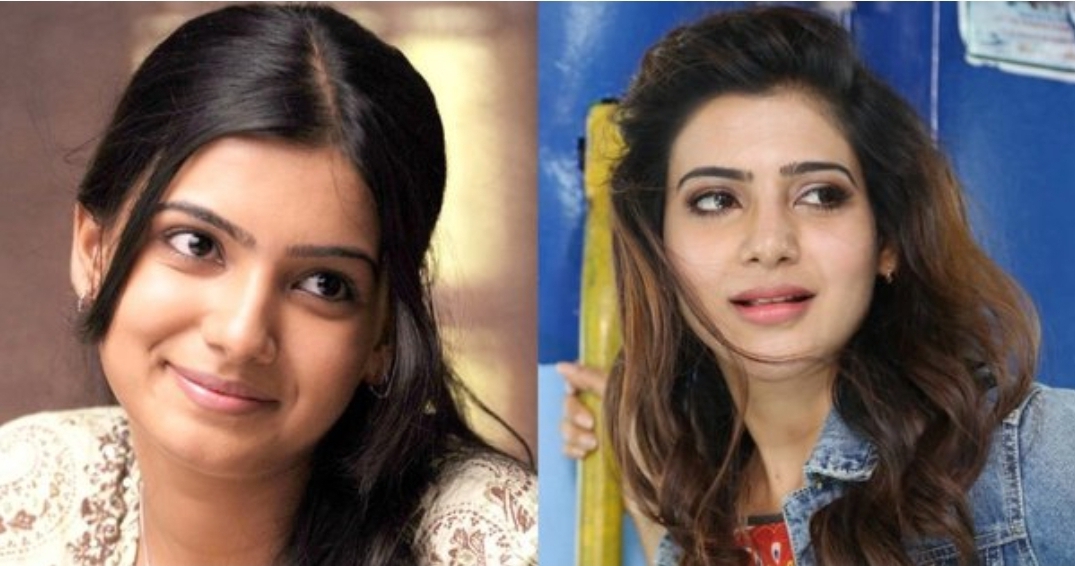 PHOTOS : பிளாஸ்டிக் சர்ஜரி மூலம் அழகுக்கு அழகு சேர்த்த டாப் 10  தென்னிந்திய நடிகைகள்.. யார் யாருன்னு தெரியுமா? லிஸ்ட் இதோ!
