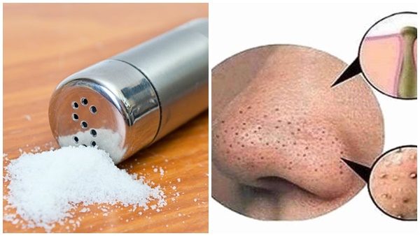 Face Care: ഇത്തിരി ഉപ്പുണ്ടോ മൂക്കിന്  ചുറ്റുമുള്ള  ബ്ലാക്ക് ഹെഡ്‌സിനെ ഇല്ലാതാക്കാം...