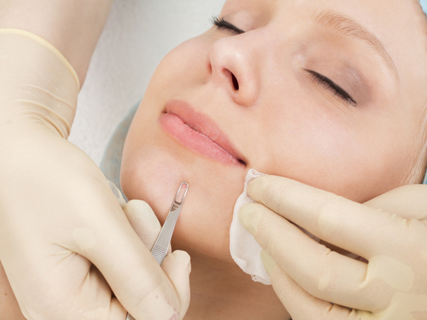  skin-ബ്ലാക്ക് ഹെഡ്സാണോ വില്ലൻ? സിമ്പിളായി തന്നെ നീക്കാം, അറിയാം മാർഗങ്ങൾ 