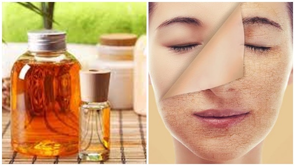 Facial Beauty: ബ്യൂട്ടിപാര്‍ലറില്‍ പോകാതെ തന്നെ മുഖത്തെ പാടുകള്‍ കളയാം; ചെയ്യേണ്ടത് ഈ 4 കാര്യങ്ങള്‍...