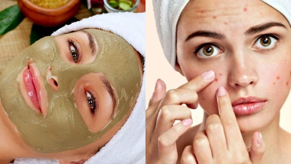  skin-മുഖക്കുരുവും കറുത്ത പാടുകളും കൊണ്ട് മടുത്തോ? ഇതല്ലേ ഫേസ്പാക്ക്, നിമിഷ നേരം കൊണ്ട് റെഡിയാക്കാം