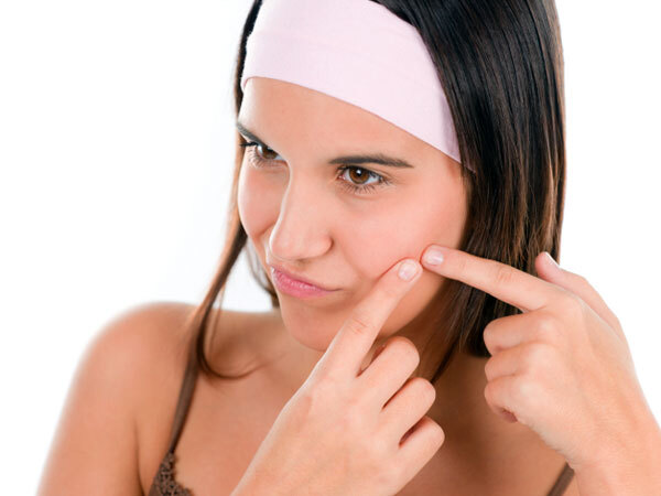 Skin: മുഖക്കുരു വല്ലാത്ത പ്രശ്‌നമാണോ? ഇതൊന്ന് പുരട്ടി നോക്കൂ; ചര്‍മം സുന്ദരമാകും