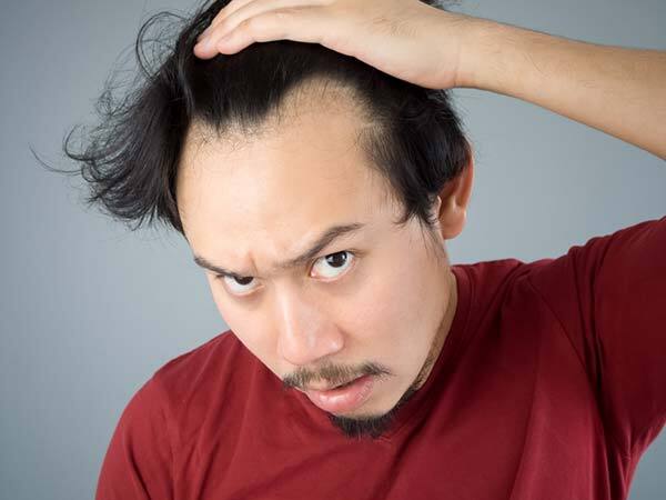 Hair loss: മുടി കൊഴിയുന്നോ; ചികിത്സയ്ക്ക് മുമ്പ് ഇക്കാര്യങ്ങള്‍ ഉറപ്പായും ശ്രദ്ധിക്കണം, ഇല്ലെങ്കില്‍ പണി കിട്ടും
