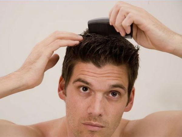 Hair loss: മുടി കൊഴിയുന്നോ; ചികിത്സയ്ക്ക് മുമ്പ് ഇക്കാര്യങ്ങള്‍ ഉറപ്പായും ശ്രദ്ധിക്കണം, ഇല്ലെങ്കില്‍ പണി കിട്ടും