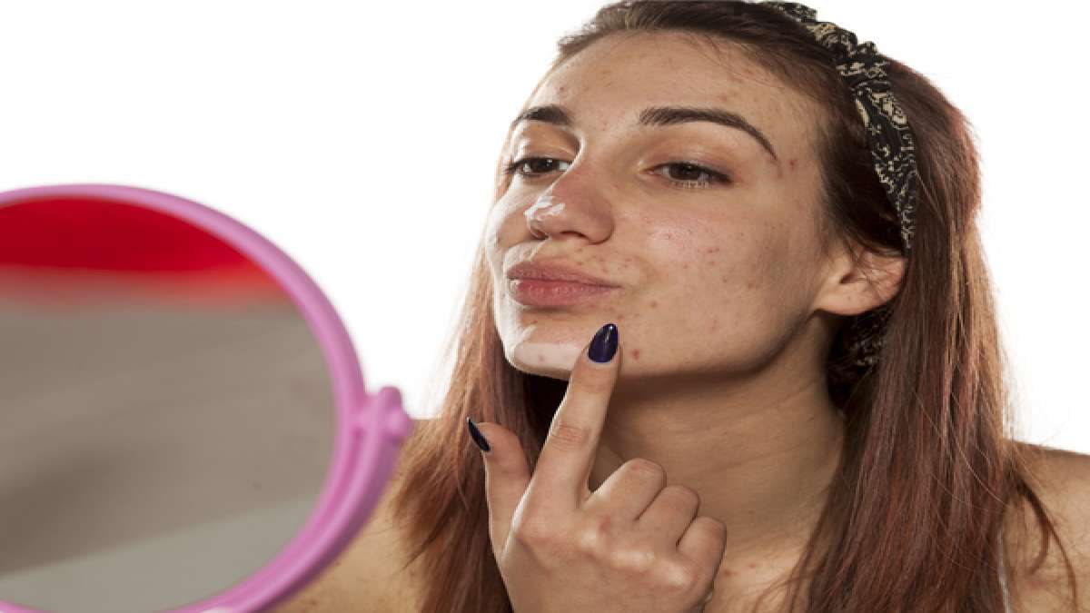 Face care: മുഖക്കുരു പമ്പ കടക്കണോ, ഇതാ ഏതാനും പൊടിക്കൈകള്‍