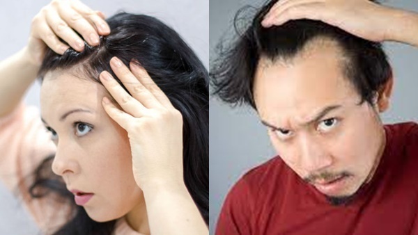  Hair lose: മുടി കൊഴിയുന്നോ? എങ്കില്‍ ഉറപ്പായും ഡോക്ടറെ കാണണം, പക്ഷെ എപ്പോള്‍ മുതല്‍