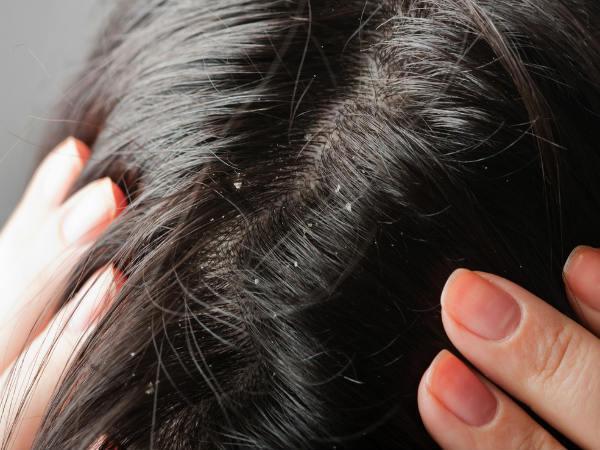 Hair tips: ഉലുവ മുടികൊഴിച്ചിലിനും വളർച്ചയ്ക്കുമുള്ള അത്ഭുത മരുന്ന്: പക്ഷെ എങ്ങനെ ഉപയോഗിക്കണം