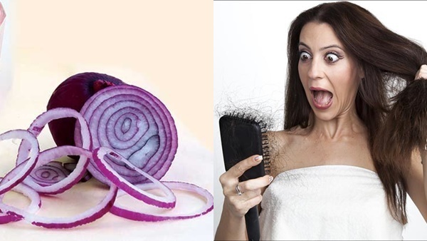 Hair Care: അല്‍പം ഉള്ളി നീരുണ്ടോ? എങ്കില്‍ മുടികൊഴിച്ചിലും താരനും ഒരു പ്രശ്നമല്ല