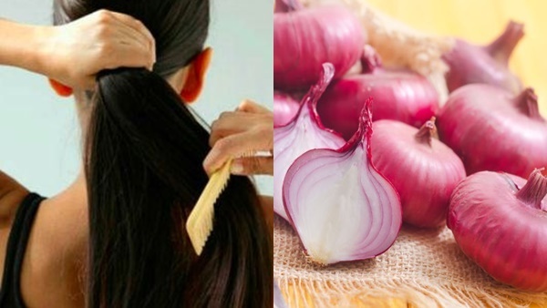 Hair Care: അല്‍പം ഉള്ളി നീരുണ്ടോ? എങ്കില്‍ മുടികൊഴിച്ചിലും താരനും ഒരു പ്രശ്നമല്ല