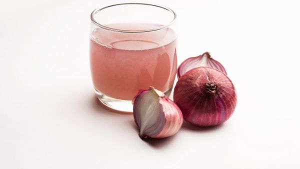 Hair Care: അല്‍പം ഉള്ളി നീരുണ്ടോ? എങ്കില്‍ മുടികൊഴിച്ചിലും താരനും ഒരു പ്രശ്നമല്ല