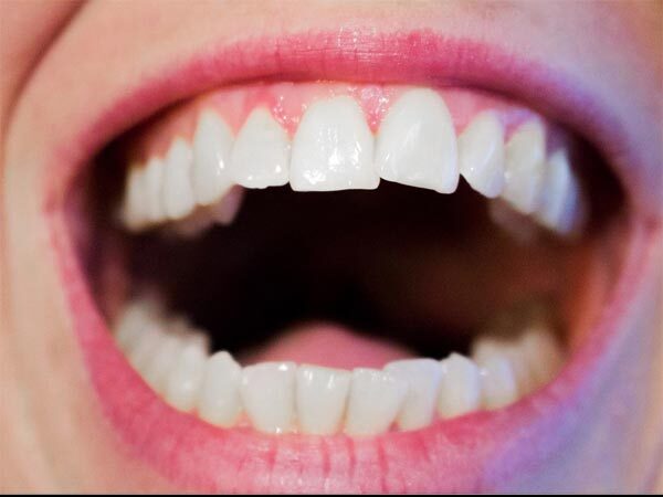 Teeth Care Tips: പല്ല് സംരക്ഷണം പേരിന് പോര, ശ്രദ്ധിക്കണം ഈ കാര്യങ്ങള്‍