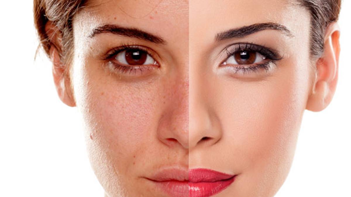 Beauty Tips For Skin: മുഖത്തെ  കരുവാളിപ്പ്  മാറിനിൽക്കും..എങ്ങനെയെന്നല്ലേ