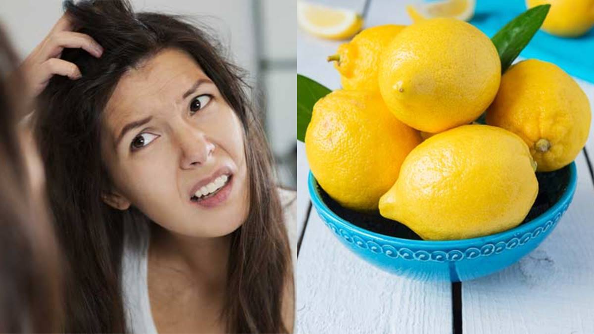  Dandruff -താരനെ തുരത്താൻ ചെറുനാരങ്ങാ ബെസ്റ്റാ..പക്ഷേ ഇങ്ങനെ ഉപയോഗിക്കാം