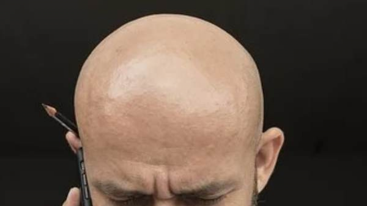 Hair Growth:  ഈ നാല് എണ്ണകൾ നിങ്ങളുടെ തലയിൽ മായാജാലം തീർക്കും.. കഷണ്ടിയിലും മുടി വരും