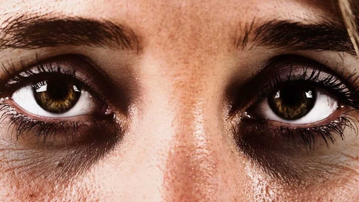 Eye Care: കണ്ണിനടിയിലെ കറുത്തപാടുകൾ  ഇനി പഴങ്കഥ, വീട്ടിൽ ഈ 4 സാധനങ്ങൾ ഉണ്ടോ?