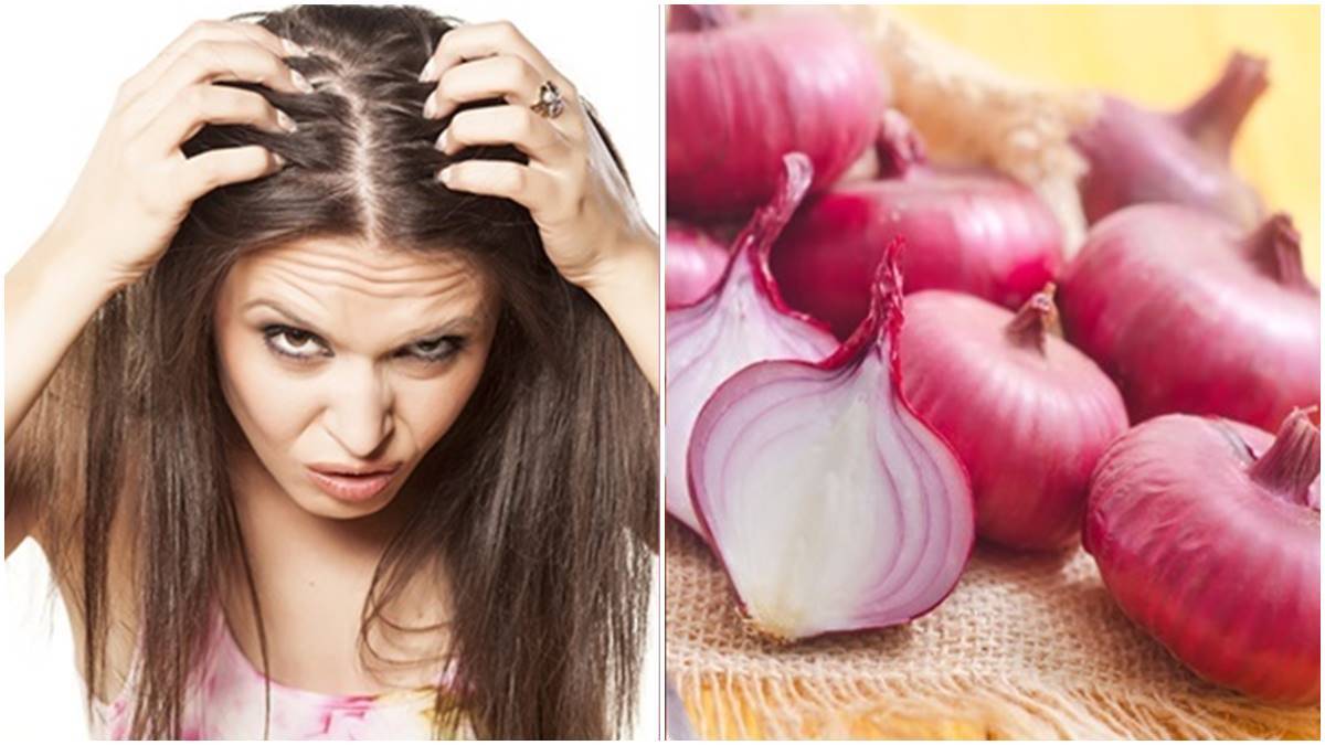 Hair Care: മുടി കൊഴിച്ചിൽ ഇനിയൊരു പ്രശ്നമേയല്ല.... കാരണം കയ്യിലുണ്ടല്ലോ ഈ പരിഹാരം 