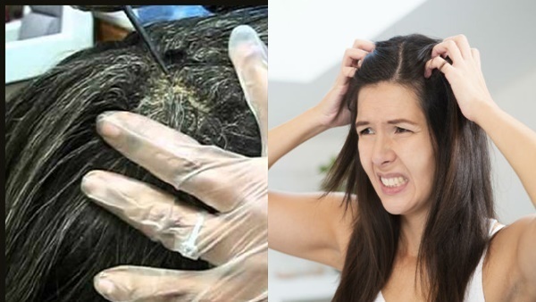Hair care:  മുടിയുടെ അറ്റം വരണ്ട് പൊട്ടുന്നോ?  ഈ രണ്ട് കാര്യങ്ങൾ ചെയ്യൂ.. ഫലം ഉറപ്പ്