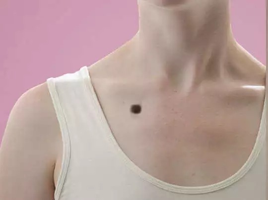 महिलाओं के अंगों के ये तिल बताते हैं उनके 'भविष्य' की कहानी, इनका मतलब