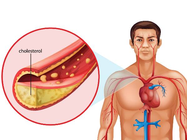 side effects on Palm oil
