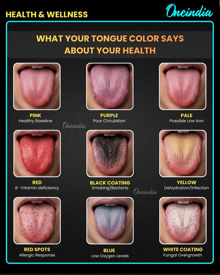 What Your Tongue Color Says About Your Health-