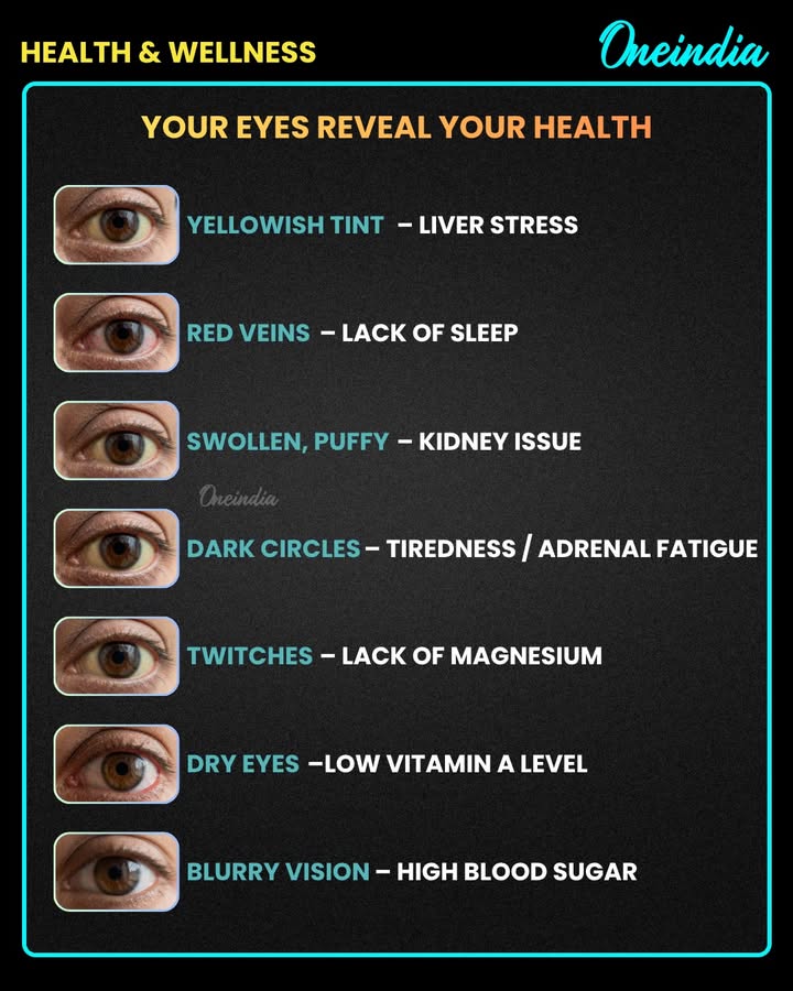 Your Eyes Reveal Your Health: Warning Signs You Shouldn’t Ignore