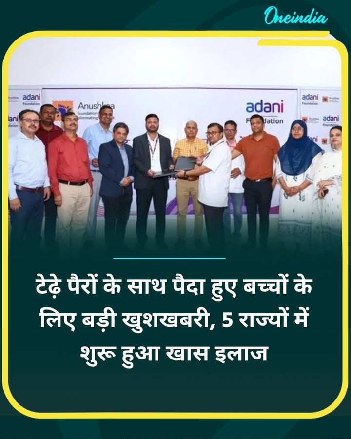 टेढ़े पैरों के साथ पैदा हुए बच्चों के लिए बड़ी खुशखबरी, 5 राज्यों में शुरू हुआ खास इलाज