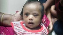 நீல நிறமாக மாறிய.. 3 மாத பச்சிளம் குழந்தையின் உடல்! உயிரை காப்பாற்ற உடனே உதவுங்கள்!