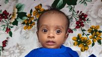 4 மாத பச்சிளம் குழந்தையின் இதய துடிப்பை காப்பாற்ற உடனே உதவுங்கள்!