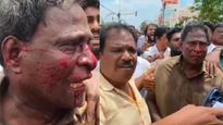 திமுக தொண்டரை ரத்தம் சொட்ட சொட்ட அடித்த போலீஸ்.. உதயநிதி கைதின்போது நடந்த சம்பவம்