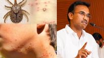 அச்சுறுத்தும் உண்ணி காய்ச்சல்.. அறிகுறிகள் என்ன? பாதிப்பு வந்தால் என்ன செய்யனும்? சுகாதாரத்துறை அட்வைஸ்
