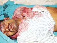 Rowdy Korangu Senthil shot down by police in Trichy Rowdy Korangu Senthil shot down by police in Trichy