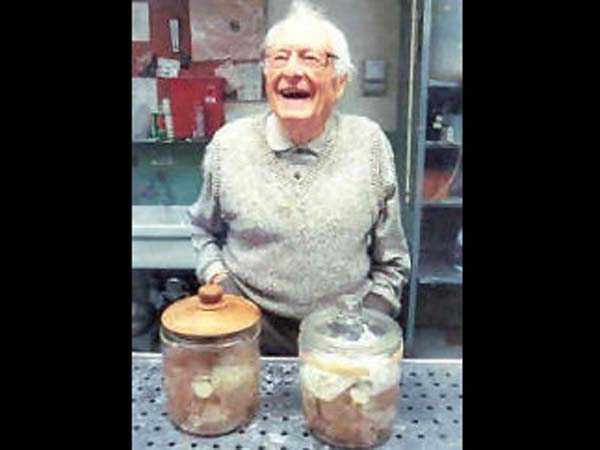 ஆராய்ச்சிக்கு உள்ளான எய்ன்ஸ்டீனின் மூளை: