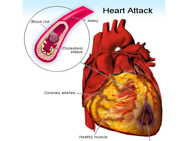 வீசப்படும் இதயங்கள் வீசப்படும் இதயங்கள்