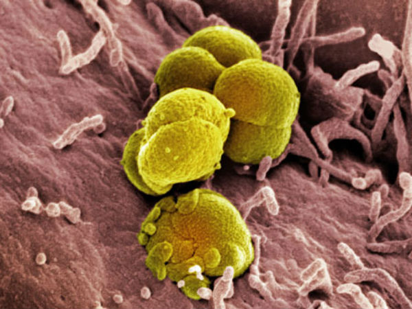 10 கோடி பேர் பாதிப்பு