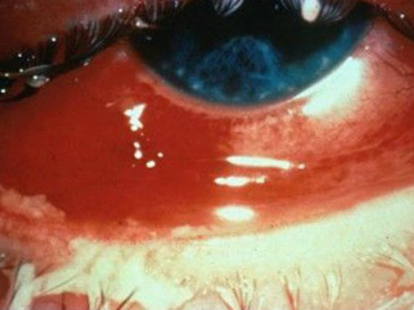 காலம் தாழ்த்தும் நிபுணர்கள்