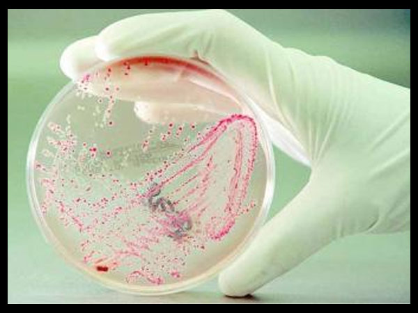 ஈ கோலினா என்ன?