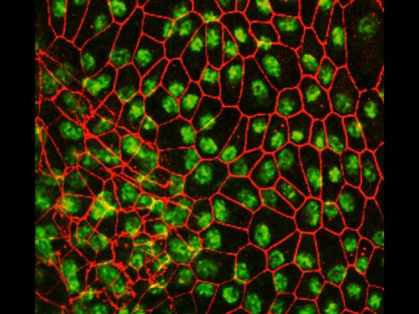 ஸ்டெம் செல் உருவாக்கம்...