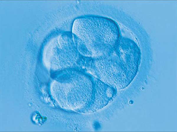 புதிய செல் பொருத்துதல்...