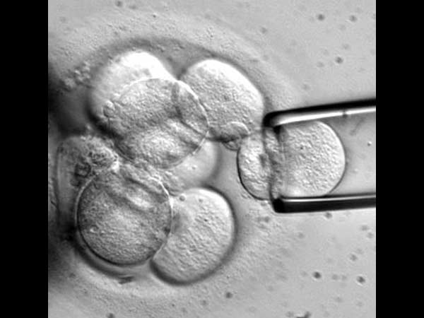 தோலை வெட்டி...