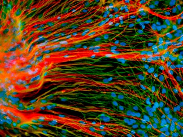 மின்சாரம் பாய்ச்சி...