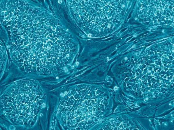 குண்டூசி தலை மாதிரி...