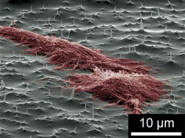 குட்டி குட்டி நீடில்கள்