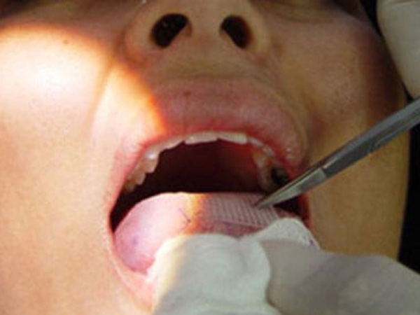 கரும்பு சாப்டுறது கஷ்டமாம்...