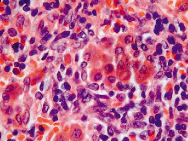 ஸ்டெம் செல் கல்லீரல்