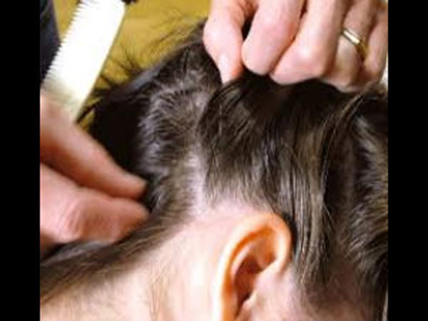 பேன் ஒரு பூச்சி...