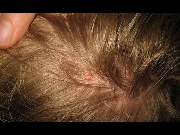 அலர்ஜி...