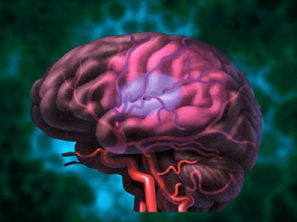 அதிக ரத்த ஓட்டம் 